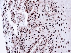 PSME3 Polyclonal Antibody, Invitrogen 100 &mu;L; Unconjugated:Antibodies,