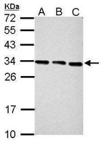 PSME3 Polyclonal Antibody, Invitrogen™