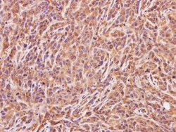 Invitrogen ACMSD Polyclonal Antibody 100 &mu;L | Buy Online | Invitrogen&trade; | Fisher Scientific