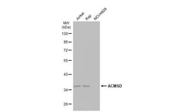 Invitrogen ACMSD Polyclonal Antibody 100 &mu;L | Buy Online | Invitrogen&trade; | Fisher Scientific
