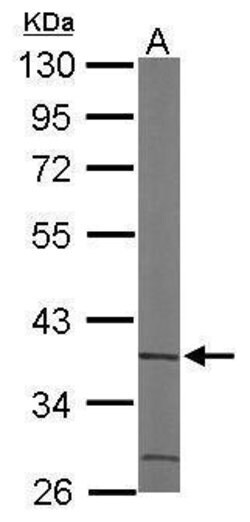Invitrogen ACMSD Polyclonal Antibody 100 &mu;L | Buy Online | Invitrogen&trade; | Fisher Scientific
