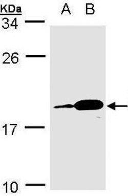 Invitrogen MZB1 Polyclonal Antibody 100 &mu;L; Unconjugated:Antibodies,