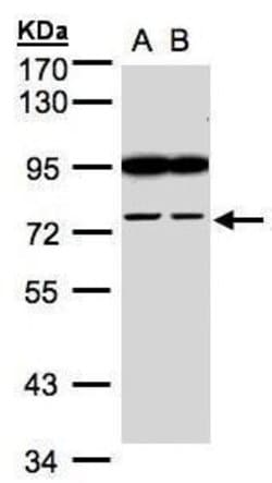 FSD2 Polyclonal Antibody:Antibodies, Polyclonal