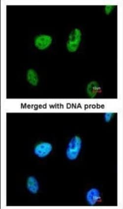 Invitrogen TATDN1 Polyclonal Antibody 100 &mu;L; Unconjugated:Antibodies,