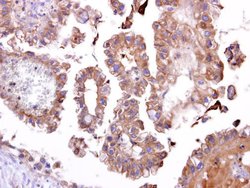 Invitrogen TATDN1 Polyclonal Antibody 100 &mu;L; Unconjugated:Antibodies,