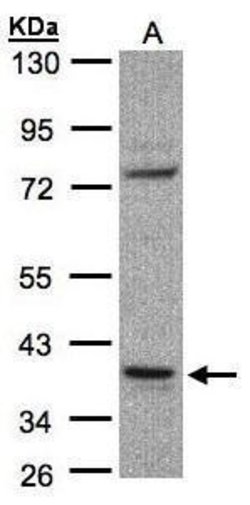 Invitrogen CCDC68 Polyclonal Antibody 100 μL; Unconjugated:Antibodies,