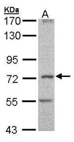 Invitrogen DNAI2 Polyclonal Antibody 100 &mu;L; Unconjugated:Antibodies,