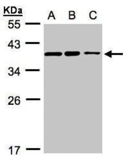 Invitrogen C9orf78 Polyclonal Antibody 100 &mu;L | Buy Online | Invitrogen&trade; | Fisher Scientific