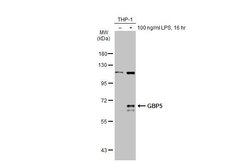 Invitrogen GBP5 Polyclonal Antibody 100 &mu;L; Unconjugated:Antibodies,