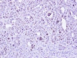 Invitrogen ZC3H8 Polyclonal Antibody 100 &mu;L; Unconjugated:Antibodies,