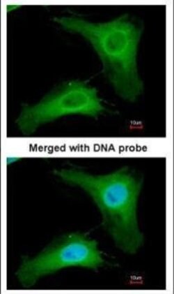 PHLP Polyclonal Antibody:Antibodies, Polyclonal