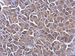 PHLP Polyclonal Antibody:Antibodies, Polyclonal