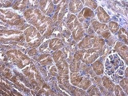 PHLP Polyclonal Antibody:Antibodies, Polyclonal