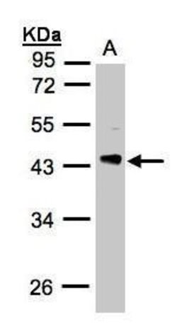 PHLP Polyclonal Antibody:Antibodies, Polyclonal