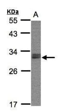 Invitrogen NSMCE1 Polyclonal Antibody 100 &mu;L | Buy Online | Invitrogen&trade; | Fisher Scientific
