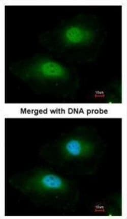 Bisphosphoglycerate mutase Polyclonal Antibody:Antibodies, Polyclonal
