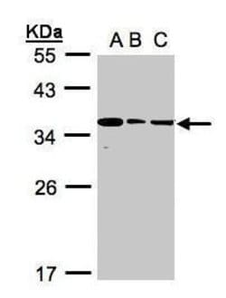 Bisphosphoglycerate mutase Polyclonal Antibody:Antibodies, Polyclonal