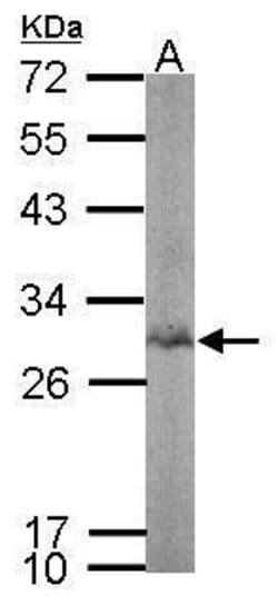 Bisphosphoglycerate mutase Polyclonal Antibody:Antibodies, Polyclonal