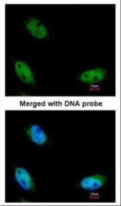 NSUN6 Polyclonal Antibody:Antibodies, Polyclonal