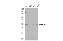 NSUN6 Polyclonal Antibody:Antibodies, Polyclonal