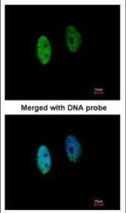 Invitrogen DENND1B Polyclonal Antibody 100 &mu;L; Unconjugated:Antibodies,