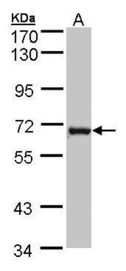Invitrogen DENND1B Polyclonal Antibody 100 &mu;L; Unconjugated:Antibodies,
