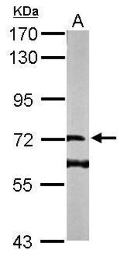 Invitrogen DENND1B Polyclonal Antibody 100 &mu;L; Unconjugated:Antibodies,