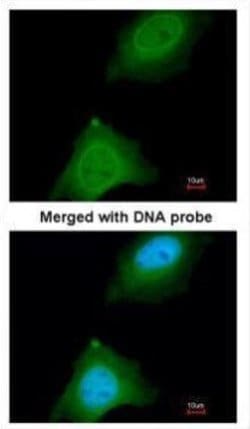 Invitrogen ASB9 Polyclonal Antibody 100 μL; Unconjugated:Antibodies,