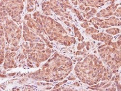Invitrogen ASB9 Polyclonal Antibody 100 μL; Unconjugated:Antibodies,