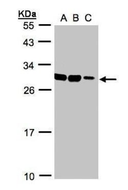 Invitrogen ASB9 Polyclonal Antibody 100 μL; Unconjugated:Antibodies,