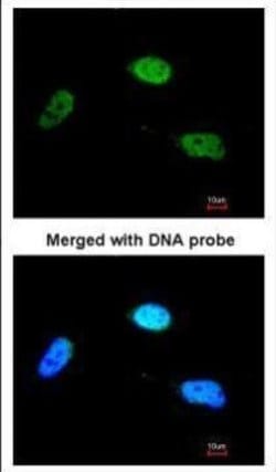 Invitrogen ZNF398 Polyclonal Antibody 100 μL; Unconjugated:Antibodies,