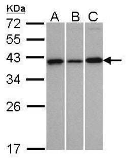 Invitrogen VTA1 Polyclonal Antibody 100 &mu;L; Unconjugated:Antibodies,