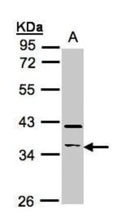 Invitrogen RASSF2 Polyclonal Antibody 100 &mu;L; Unconjugated:Antibodies,