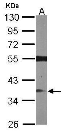 Invitrogen RASSF2 Polyclonal Antibody 100 &mu;L; Unconjugated:Antibodies,