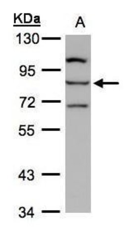 Invitrogen ALOXE3 Polyclonal Antibody 100 &mu;L; Unconjugated:Antibodies,