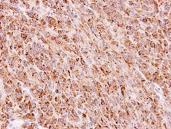 Invitrogen TTC30A Polyclonal Antibody 100 μL; Unconjugated:Antibodies,