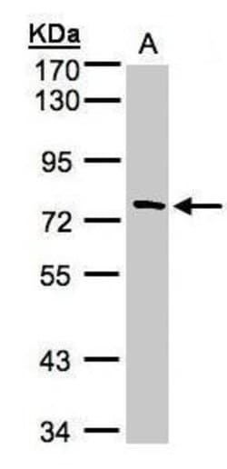 Invitrogen TTC30A Polyclonal Antibody 100 μL; Unconjugated:Antibodies,