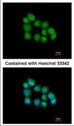 Invitrogen MBNL3 Isoform G Polyclonal Antibody 100 &mu;L; Unconjugated:Antibodies,