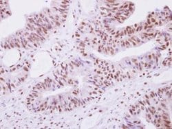 Invitrogen SEPHS1 Polyclonal Antibody 100 &mu;L; Unconjugated:Antibodies,