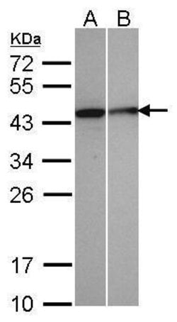 Invitrogen SEPHS1 Polyclonal Antibody 100 &mu;L; Unconjugated:Antibodies,