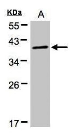 Invitrogen PKA alpha Polyclonal Antibody 100 &mu;L; Unconjugated:Antibodies,