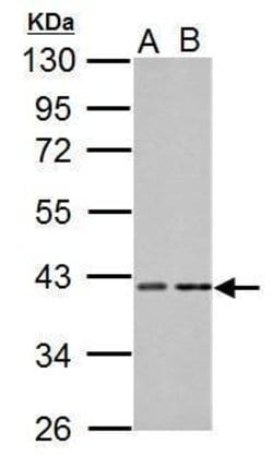 Invitrogen PKA alpha Polyclonal Antibody 100 &mu;L; Unconjugated:Antibodies,