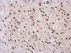 Invitrogen MPP3 Polyclonal Antibody 100 &mu;L; Unconjugated:Antibodies,