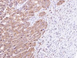 Invitrogen STK25 Polyclonal Antibody 100 &mu;L | Buy Online | Invitrogen&trade; | Fisher Scientific