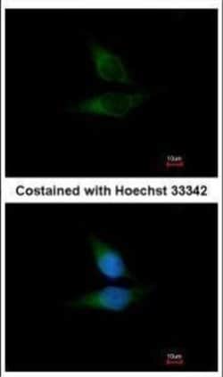 Invitrogen ORP1 Polyclonal Antibody 100 &mu;L; Unconjugated:Antibodies,