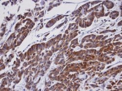 Invitrogen ORP1 Polyclonal Antibody 100 &mu;L; Unconjugated:Antibodies,
