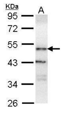 Invitrogen ORP1 Polyclonal Antibody 100 &mu;L; Unconjugated:Antibodies,