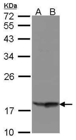 Invitrogen RARRES3 Polyclonal Antibody 100 &mu;L; Unconjugated:Antibodies,