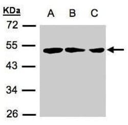 Invitrogen ZMYND10 Polyclonal Antibody 100 μL; Unconjugated:Antibodies,