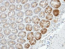 Invitrogen MST4 Polyclonal Antibody 100 &mu;L; Unconjugated:Antibodies,